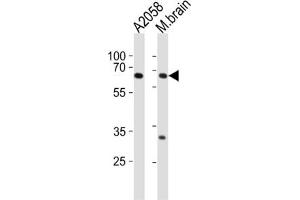 Western Blotting (WB) image for anti-Leucine Zipper, Putative Tumor Suppressor 1 (LZTS1) antibody (ABIN2997120)