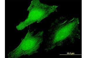 Immunofluorescence of  purified  MaxPab antibody to CLUHP3 on HeLa cell. (CLUHP3 antibody  (AA 1-147))