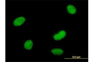 Immunofluorescence of purified MaxPab antibody to SMARCAL1 on HeLa cell.