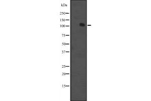 Western blot analysis of MCF2 expression in K562 cell line lysate ;,The lane on the left is treated with the antigen-specific peptide.
