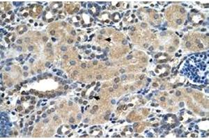Immunohistochemical staining (Formalin-fixed paraffin-embedded sections) of human kidney with ASPH polyclonal antibody  at 4-8 ug/mL working concentration. (Aspartate beta Hydroxylase antibody  (N-Term))