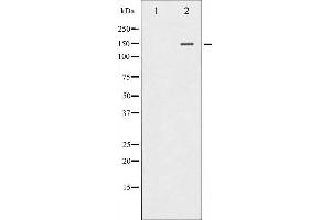 Western blot analysis of PLCG1 expression in EGF treated COS7 whole cell lysates,The lane on the left is treated with the antigen-specific peptide. (Phospholipase C gamma 1 antibody)