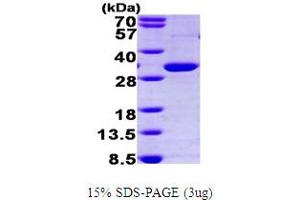 SDS-PAGE (SDS) image for Peroxisome Proliferator-Activated Receptor gamma (PPARG) (AA 209-477) protein (His tag) (ABIN667157)