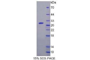 SDS-PAGE (SDS) image for Folate Hydrolase (Prostate-Specific Membrane Antigen) 1 (FOLH1) (AA 536-752) protein (His tag) (ABIN4989315) (PSMA Protein (AA 536-752) (His tag))