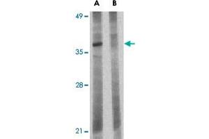 Western blot analysis of BCL2L10 in Jurkat lysate with BCL2L10 polyclonal antibody  at 1 ug/mL in the (A) absence and (B) presence of blocking peptide. (BCL2L10 antibody  (N-Term))