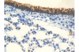 IHC-P analysis of Mouse Lung Tissue, with DAB staining. (Androgen Receptor antibody  (AA 156-310))