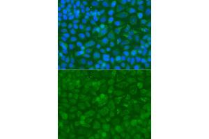 Immunofluorescence analysis of A549 cell using ACAD9 antibody. (ACAD9 antibody)