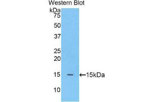 Western Blotting (WB) image for anti-Meningioma Expressed Antigen 5 (Hyaluronidase) (MGEA5) (AA 695-814) antibody (ABIN1859959) (MGEA5 antibody  (AA 695-814))