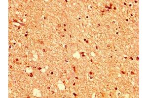 IHC image of ABIN7151835 diluted at 1:400 and staining in paraffin-embedded human brain tissue performed on a Leica BondTM system. (EPH Receptor A2 antibody  (AA 627-976))