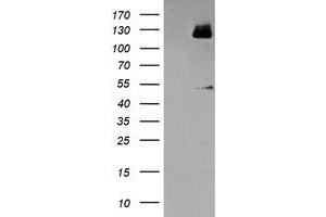 HEK293T cells were transfected with the pCMV6-ENTRY control (Left lane) or pCMV6-ENTRY MEF2C (Right lane) cDNA for 48 hrs and lysed. (MEF2C antibody)