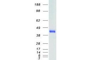 Western Blotting (WB) image for Somatostatin Receptor 2 (SSTR2) protein (Myc-DYKDDDDK Tag) (ABIN2732713)