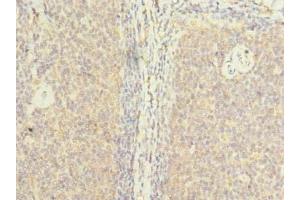 Immunohistochemistry of paraffin-embedded human tonsil tissue using ABIN7176663 at dilution of 1:100 (ZHX1-C8ORF76 Readthrough (ZHX1-C8ORF76) (AA 1-292), (Isoform 2) antibody)