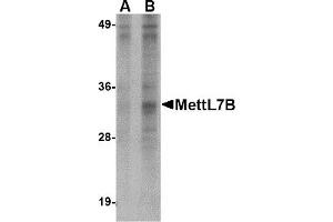 Western Blotting (WB) image for anti-Methyltransferase Like 7B (METTL7B) (N-Term) antibody (ABIN1031456)
