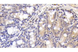 Detection of C4B in Mouse Colon Tissue using Polyclonal Antibody to Complement C4-B (C4B) (C4B antibody  (AA 126-366))