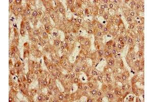 Immunohistochemistry of paraffin-embedded human liver tissue using ABIN7144112 at dilution of 1:100 (ANGPTL3 antibody  (AA 17-268))