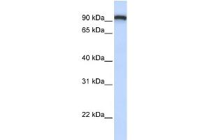 WB Suggested Anti-TMEM168 Antibody Titration:  0. (TMEM168 antibody  (C-Term))