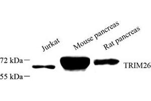Western blot analysis of TRIM26 (ABIN7076014) at dilution of 1: 1500