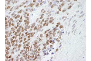 Immunohistochemistry (IHC) image for anti-Chromobox Homolog 3 (CBX3) (C-Term) antibody (ABIN7448460) (CBX3 antibody  (C-Term))