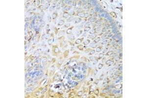 Immunohistochemistry of paraffin-embedded human esophagus using MYH9 antibody. (Myosin 9 antibody)