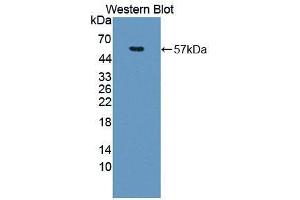 Western blot analysis of the recombinant protein. (NUP50 antibody  (AA 179-428))