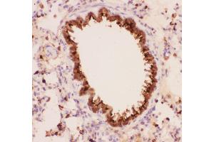 Anti-Annexin A1 Picoband antibody,  IHC(P): Rat Lung Tissue (Annexin a1 antibody  (AA 2-346))