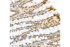Immunohistochemistry (Paraffin-embedded Sections) (IHC (p)) image for anti-Transketolase (TKT) antibody (ABIN7075978)