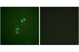 Immunofluorescence analysis of A549 cells, using PLK1 (Ab-210) Antibody. (PLK1 antibody  (AA 176-225))