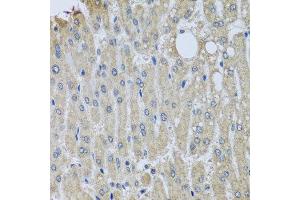 Immunohistochemistry of paraffin-embedded human liver injury using SYT11 antibody at dilution of 1:100 (x40 lens). (SYT11 antibody)