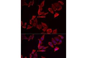 Immunofluorescence analysis of MCF7 cells using SKAP2 Polyclonal Antibody (SKAP2 antibody)