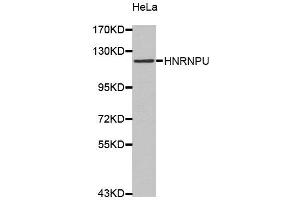 Western Blotting (WB) image for anti-Heterogeneous Nuclear Ribonucleoprotein U (Scaffold Attachment Factor A) (HNRNPU) antibody (ABIN1873068)