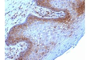 Immunohistochemistry (IHC) image for anti-beta-2-Microglobulin (B2M) antibody (ABIN6940415)