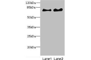 Western blot All lanes: INTS10 antibody at 4. (INTS1 antibody  (AA 451-710))