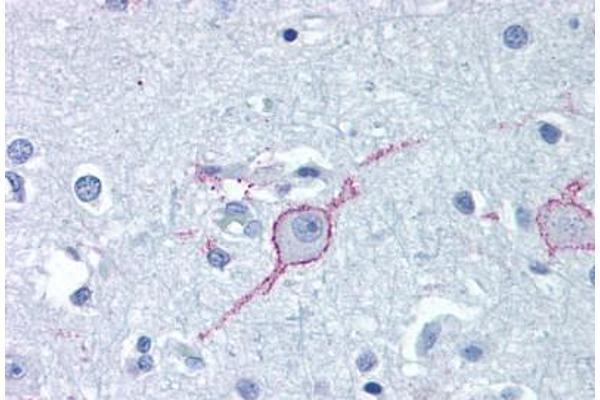 GALR3 antibody  (Extracellular Domain)