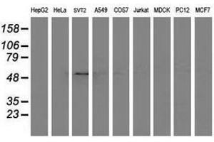 Image no. 3 for anti-Adaptor-Related Protein Complex 2, mu 1 Subunit (AP2M1) (AA 97-383) antibody (ABIN1491721) (AP2M1 antibody  (AA 97-383))