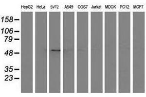 Image no. 3 for anti-Adaptor-Related Protein Complex 2, mu 1 Subunit (AP2M1) (AA 97-383) antibody (ABIN1491721) (AP2M1 antibody  (AA 97-383))