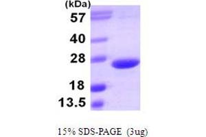 SDS-PAGE (SDS) image for Tumor Necrosis Factor (Ligand) Superfamily, Member 15 (TNFSF15) (AA 72-251) protein (His tag) (ABIN666796) (TNFSF15 Protein (AA 72-251) (His tag))