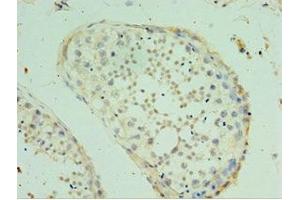 Immunohistochemistry of paraffin-embedded human testis tissue using ABIN7170476 at dilution of 1:100 (SPAG16 antibody  (AA 1-183))