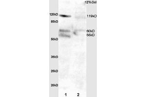 L1 mouse intestine lysate L2 rat lung lysates probed with Anti Phospho-FAK (Tyr397)Polyclonal Antibody, Unconjugated  at 1:3000 for 90 min at 37˚C. (FAK antibody  (pTyr397))