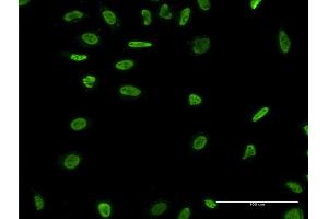 Immunofluorescence of monoclonal antibody to RAD18 on HeLa cell. (RAD18 antibody  (AA 332-430))