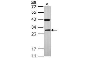 WB Image Sample (30 ug of whole cell lysate) A: H1299 12% SDS PAGE antibody diluted at 1:1000 (Rab3c antibody)