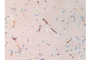 IHC-P analysis of Human Brain Tissue, with DAB staining. (HBd antibody  (AA 1-143))