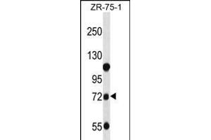 GUSB Antibody (C-term) (ABIN656383 and ABIN2845678) western blot analysis in ZR-75-1 cell line lysates (35 μg/lane). (Glucuronidase beta antibody  (C-Term))