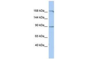 Image no. 1 for anti-N(alpha)-Acetyltransferase 15, NatA Auxiliary Subunit (NAA15) (AA 323-372) antibody (ABIN6743508) (NAA15 antibody  (AA 323-372))