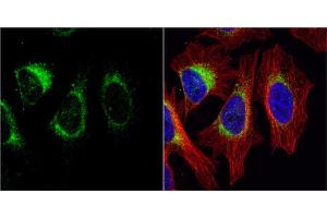 ICC/IF Image Tyrosine Hydroxylase antibody [N1C1] detects Tyrosine Hydroxylase protein at cytoplasm by immunofluorescent analysis.