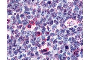 Anti-GPR146 antibody IHC of human tonsil germinal center. (GPR146 antibody  (Cytoplasmic Domain))