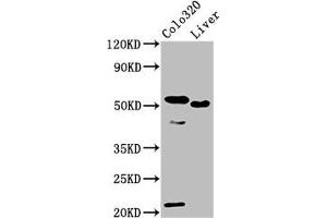 Western Blot Positive WB detected in: Colo320 whole cell lysate, Rat liver tissue All lanes: OLFM4 antibody at 10 μg/mL Secondary Goat polyclonal to rabbit IgG at 1/50000 dilution Predicted band size: 58 kDa Observed band size: 58 kDa