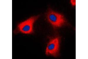 Immunofluorescent analysis of BCKDK staining in HeLa cells. (BCKDK antibody  (N-Term))