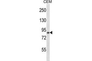 Western Blotting (WB) image for anti-ADAM Metallopeptidase Domain 11 (ADAM11) antibody (ABIN2997715)