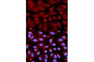 Immunofluorescence analysis of U2OS cell using CD70 antibody. (CD70 antibody  (AA 39-193))