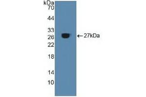 Detection of Recombinant ACO1, Human using Polyclonal Antibody to Aconitase 1 (ACO1) (Aconitase 1 antibody  (AA 251-443))